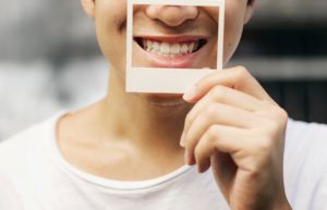 Te gandesti la implanturi dentare? Ai facut o decizie buna!
