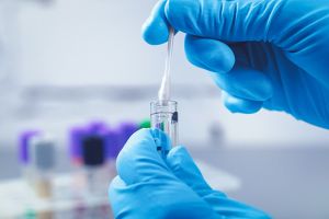 Conducerea Spitalului Judeţean Galaţi: Avem peste 14.602 de pacienţi trataţi. Nu 1.800 aşa cum a spus Ministrul Sănătăţii 