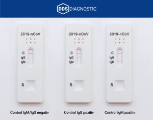 Compania DDS Diagnostic a creat prima trusă din Europa pentru detectarea rapidă a COVID-19