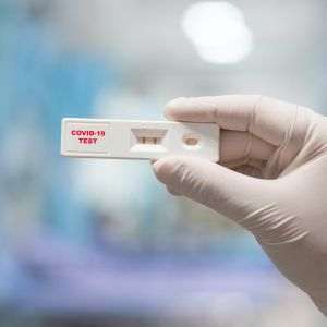Testele rapide sunt recunoscute oficial pentru diagnosticarea COVID-19