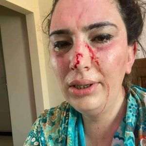 Silsila Alikhil (Sursa foto: Twitter)