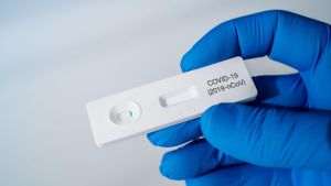 Ministerul Educaţiei solicită clarificări referitoare la efectuarea testelor COVID rapide antigen din salivă