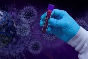 3.605 de cazuri noi de infectare cu SARS-CoV-2 