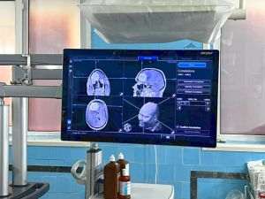 Prima operaţie pe creier realizată cu ajutorul Sistemului de Neuronavigaţie, la spitalul Judeţean Galaţi