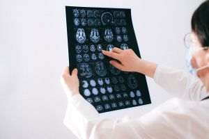 Technology - detecting Alzheimer and #39;s disease before symptoms appear