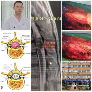 Nouă premieră medicală în neurochirurgie, la Spitalul Judeţean de Urgenţă 