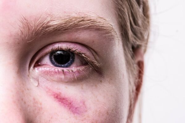 Parlamentul Ungariei a respins ratificarea tratatului internaţional care protejează femeile împotriva violenţelor