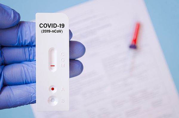 Testare pentru COVID-19 gratuită pentru românii care trec din Marea Britanie în Franţa