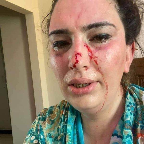 Silsila Alikhil (Sursa foto: Twitter)