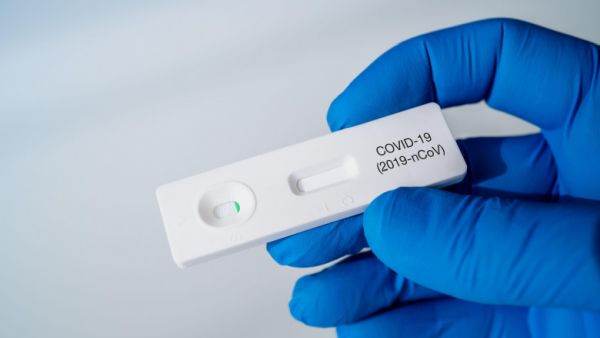 Ministerul Educaţiei solicită clarificări referitoare la efectuarea testelor COVID rapide antigen din salivă