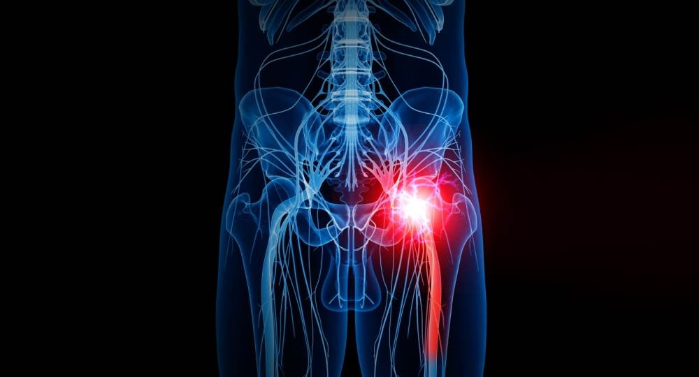 MedLife inaugurează, în premieră pentru Europa de Sud-Est, Centrul de Excelenţă în Neurochirurgia Pelvină, dedicat tratării durerii pelvine cronice