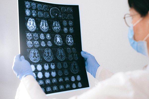 Researchers develop personalized immunotherapy against one of the most aggressive brain tumors