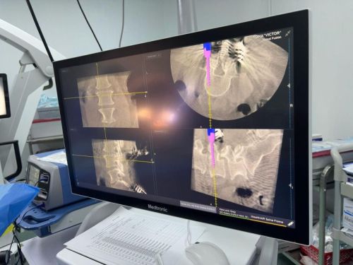 Sedentarismul şi tehnologia - factori de risc pentru afecţiuni neurochirurgicale; Cum prevenim apariţia lor
